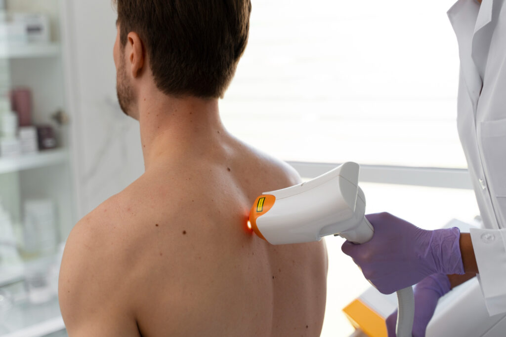 Hair laser removal man back skin at medical spa